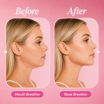 Miocure Beautysleep Tape