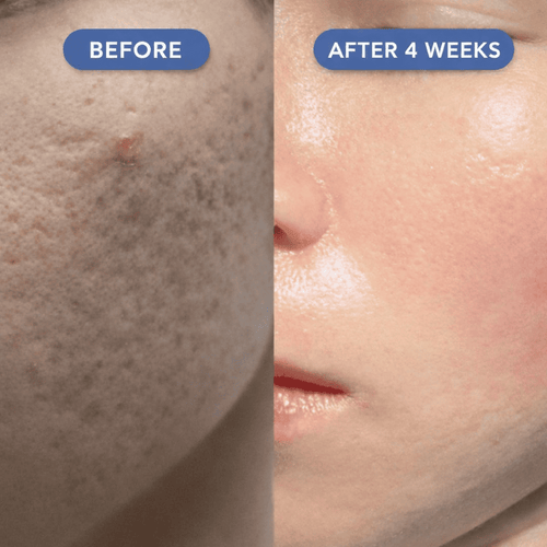 Copper Peptide Serum (GHK-CU)