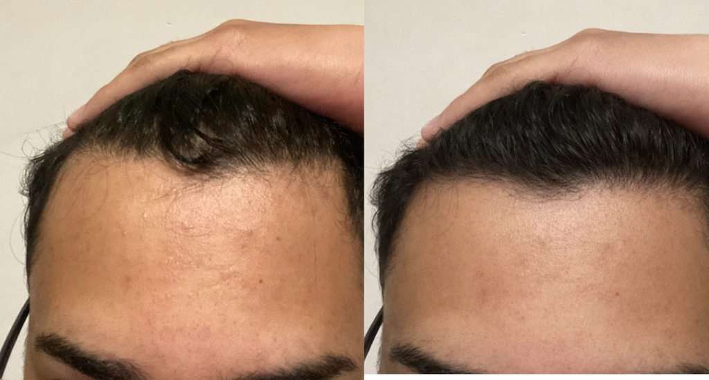 Rosemary Hair Growth Serum