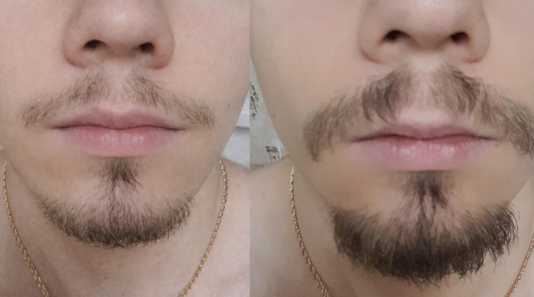 Rosemary Hair Growth Serum